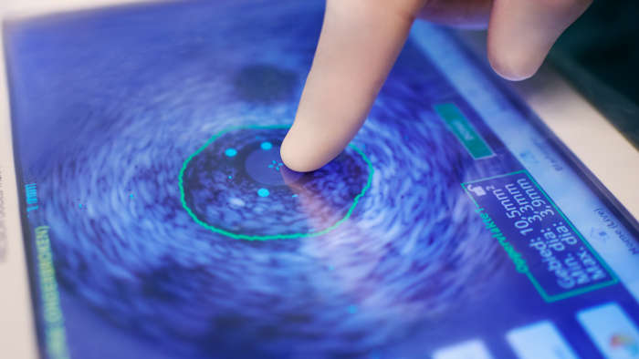 Peripheral therapy devices