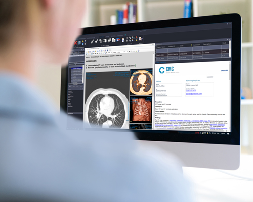 Diagnostic viewer looking at images Perfusion MR