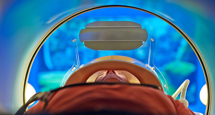 70% reduction in MRI rescans