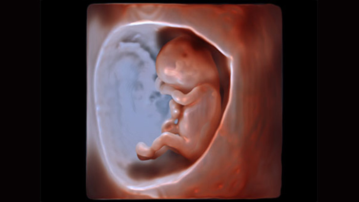 Fetal 3D ultrasound image with obstetric ultrasound