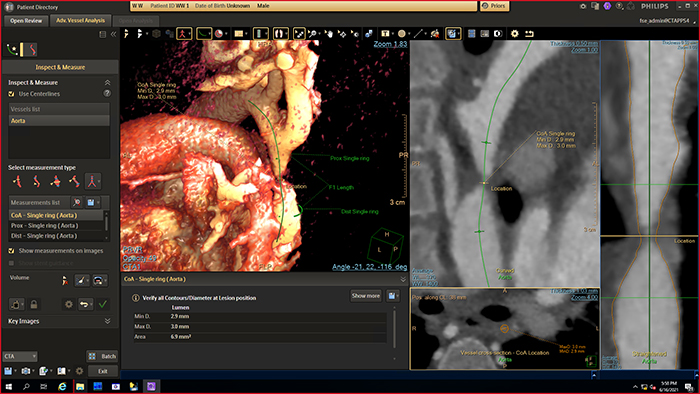 IntelliSpace Cardiovascular