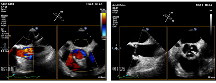 Live xPlane image with xMatrix technology 