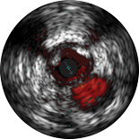 Bifurcation image