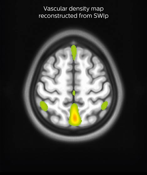 Sherbrooke_SWIp