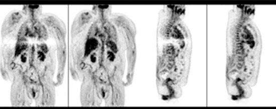 scan image2