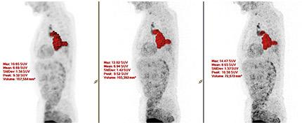 small lesion